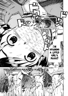 [Awaji Himeji] Shouni Byouto Sanfujinka | Pediatric Ward Gynecology Department (Sugo! Loli) [English] [Fated Circle] - page 17