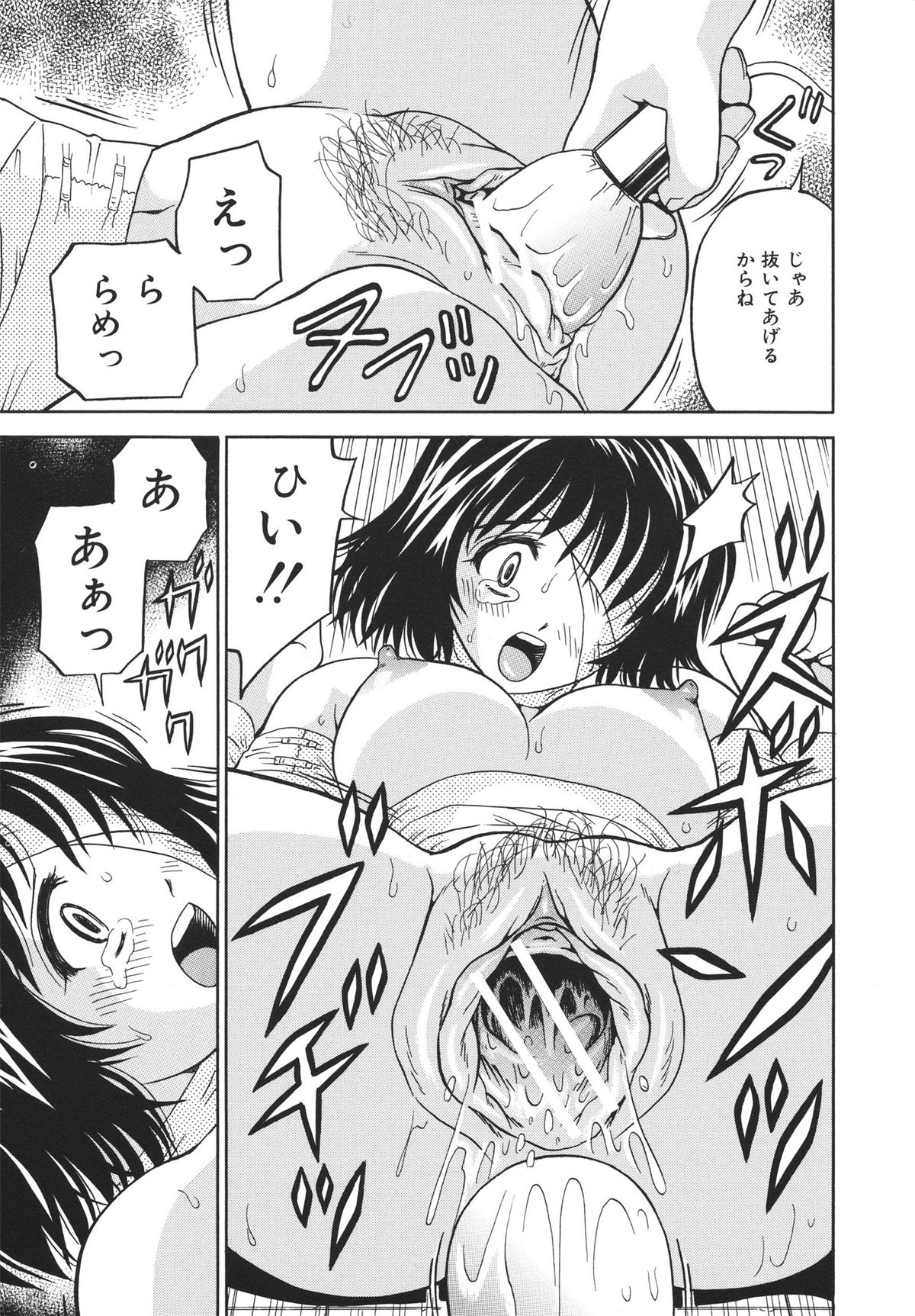 [Atori K] Houtai Shoujo - Bandage Girl page 41 full