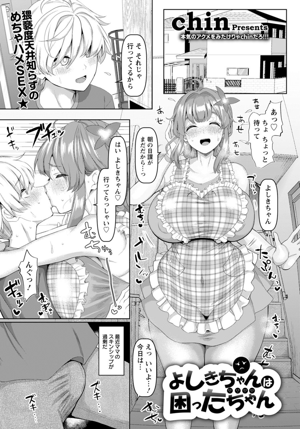 [Chin] Yoshiki-chan wa komattachan page 1 full